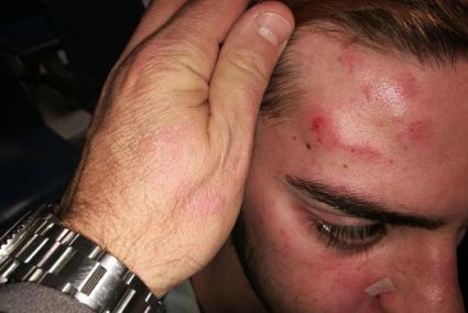 Els joves foren increpats i agredits per la seva condició sexual i per parlar en català.