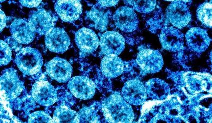 Sóller arriba als 80 casos actius de coronavirus