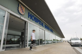 El PP de Menorca insta el Govern a no demorar la instal·lació del servei de radioteràpia