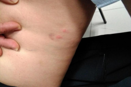 Denuncien una plaga de puces a l'aeroport de Palma