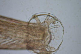 La UIB detecta a Mallorca un cuc que pot provocar meningitis