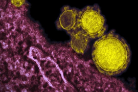 Les Balears han augmentat en 18 casos les xifres d'infectats per coronavirus.