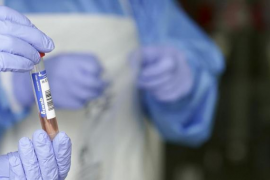 Comptabilitzen 310 casos nous de Covid-19 des de divendres a les Balears