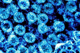 Sóller arriba als 80 casos actius de coronavirus