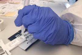 Coronavirus.- Baleares notifica 238 casos de COVID-19 y un fallecido