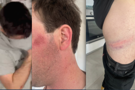 L'actuació de la Policia d'Alcúdia, dirigida per VOX, deixa diverses persones ferides