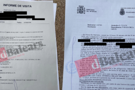 Guàrdies de seguretat de Son Espases agredeixen físicament una pacient per haver-los parlat en català, mentre li criden «en español!»