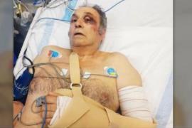 Tornen a la feina els policies alemanys que varen apallissar un taxista a Mallorca